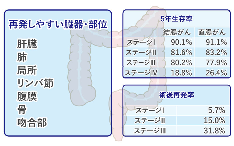 再発した甲状腺がんの生存率