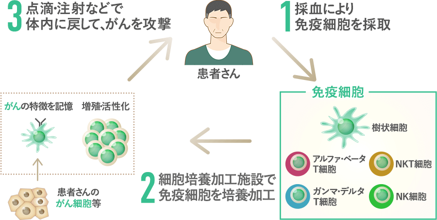 1.採血により免疫細胞を採取　2.細胞培養施設で免疫細胞を加工　3.点滴・注射などで体内に戻して、がんを攻撃