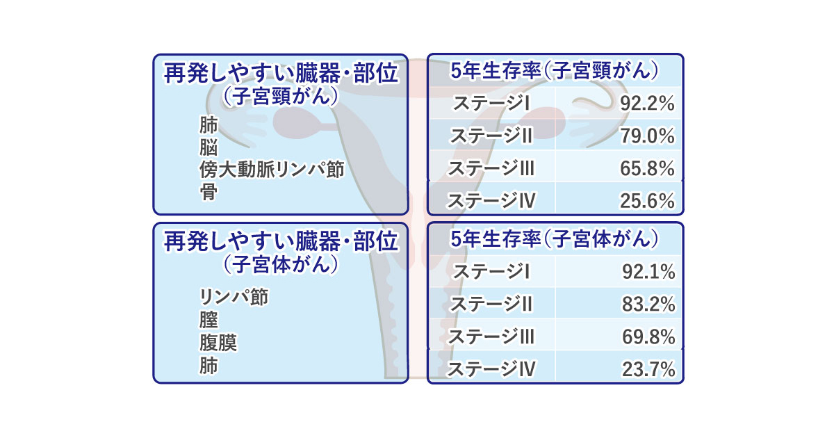 子宮摘出術の種類